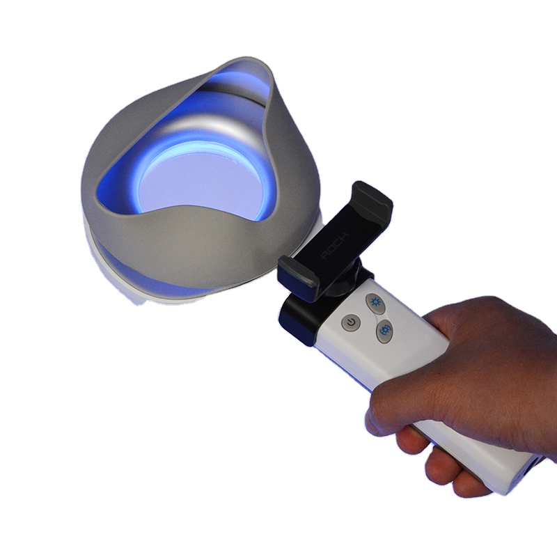 Skin Disorder  Depigmentation  - Led Medical Headlight ulasan dan harga