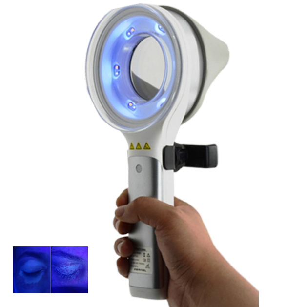 Skin Disorder  Depigmentation  - Led Medical Headlight ulasan dan harga